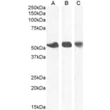 Western Blot - Anti-ENT1 Antibody (A83640) - Antibodies.com