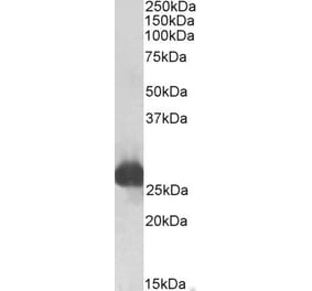 Western Blot - Anti-GSTA3 Antibody (A83641) - Antibodies.com