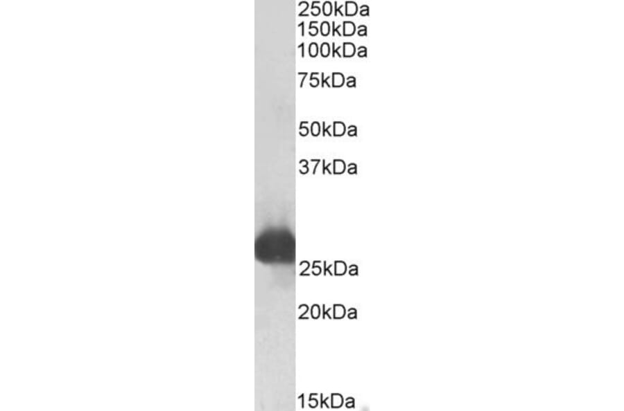 Western Blot - Anti-GSTA3 Antibody (A83641) - Antibodies.com