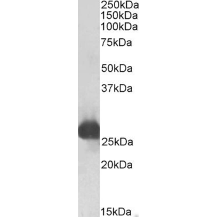 Western Blot - Anti-GSTA3 Antibody (A83641) - Antibodies.com