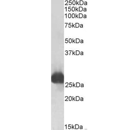 Western Blot - Anti-Gsta3 Antibody (A83641) - Antibodies.com