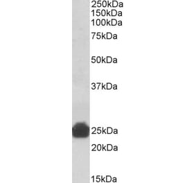 Western Blot - Anti-GSTA3 Antibody (A83642) - Antibodies.com