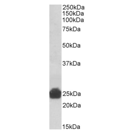 Western Blot - Anti-GSTA3 Antibody (A83642) - Antibodies.com