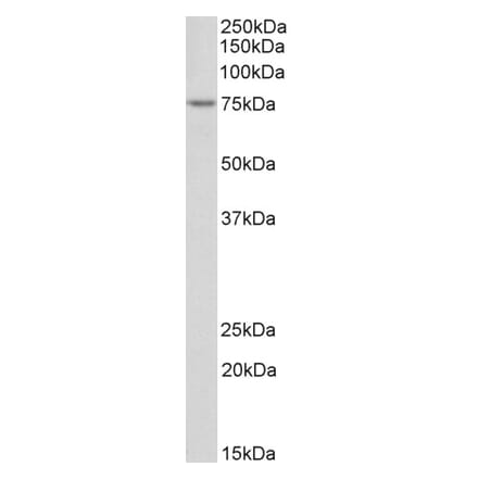 Western Blot - Anti-TDP1 Antibody (A83643) - Antibodies.com