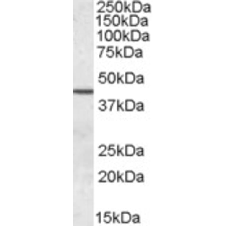 Western Blot - Anti-Septin 2 Antibody (A83644) - Antibodies.com