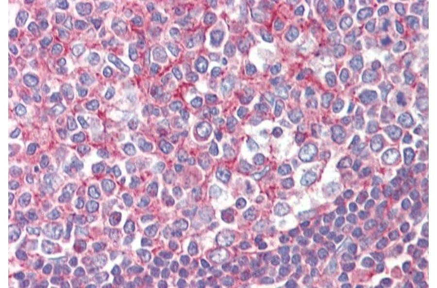 Immunohistochemistry - Anti-Septin 2 Antibody (A83644) - Antibodies.com