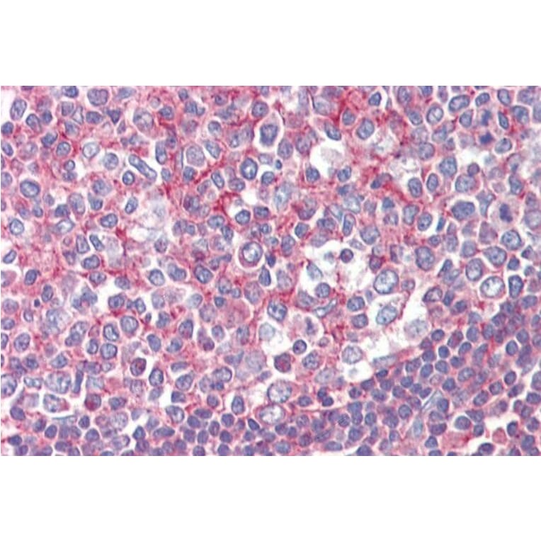 Immunohistochemistry - Anti-Septin 2 Antibody (A83644) - Antibodies.com