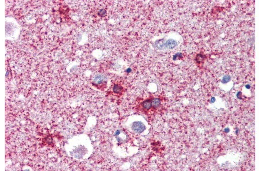 Immunohistochemistry - Anti-Septin 2 Antibody (A83644) - Antibodies.com