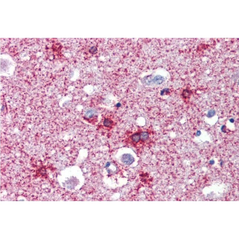 Immunohistochemistry - Anti-Septin 2 Antibody (A83644) - Antibodies.com