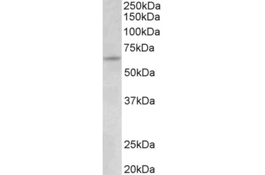 Western Blot - Anti-UMOD Antibody (A83645) - Antibodies.com