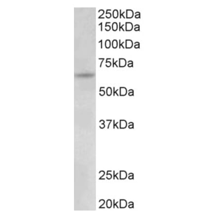 Western Blot - Anti-UMOD Antibody (A83645) - Antibodies.com
