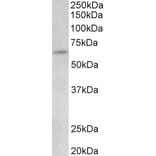 Western Blot - Anti-UMOD Antibody (A83645) - Antibodies.com
