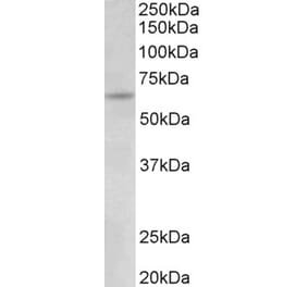 Western Blot - Anti-UMOD Antibody (A83645) - Antibodies.com
