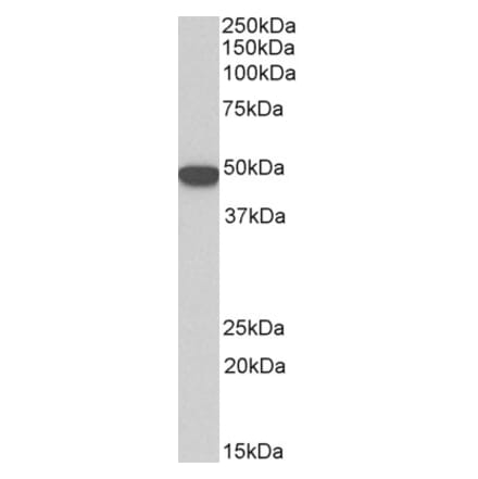 Western Blot - Anti-Cytokeratin 18 Antibody (A83652) - Antibodies.com