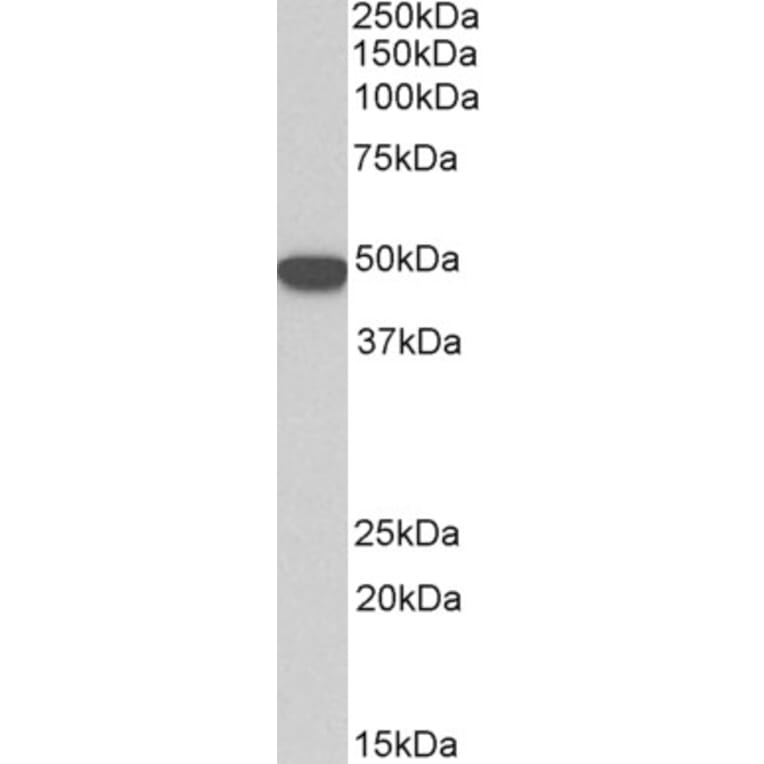 Western Blot - Anti-Cytokeratin 18 Antibody (A83652) - Antibodies.com