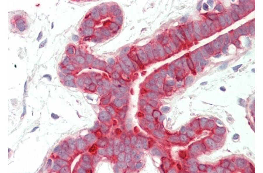 Immunohistochemistry - Anti-Cytokeratin 18 Antibody (A83652) - Antibodies.com