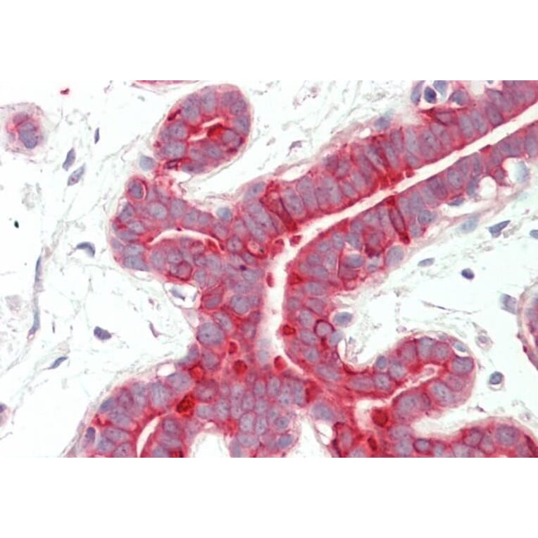 Immunohistochemistry - Anti-Cytokeratin 18 Antibody (A83652) - Antibodies.com