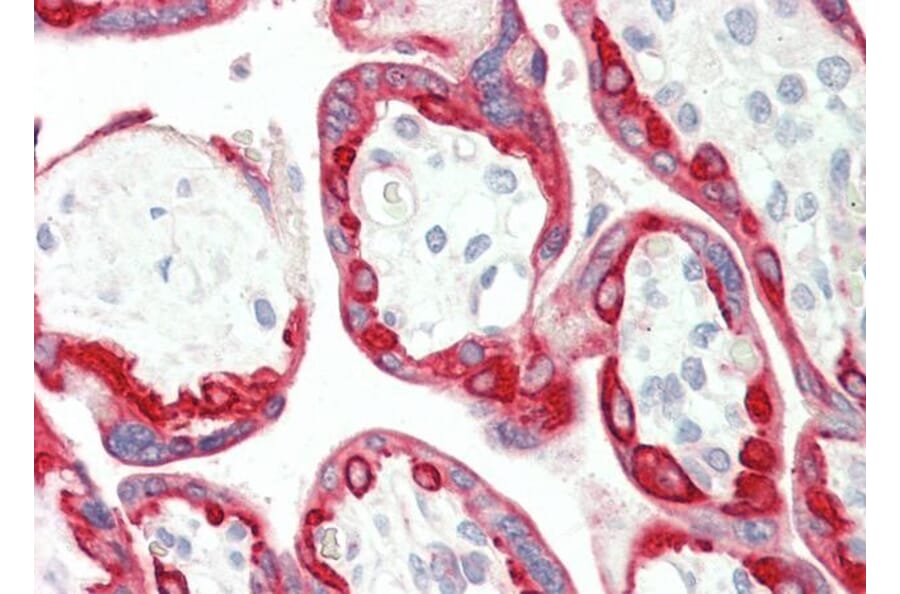 Immunohistochemistry - Anti-Cytokeratin 18 Antibody (A83652) - Antibodies.com
