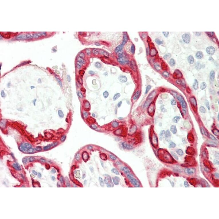 Immunohistochemistry - Anti-Cytokeratin 18 Antibody (A83652) - Antibodies.com