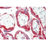 Immunohistochemistry - Anti-Cytokeratin 18 Antibody (A83652) - Antibodies.com