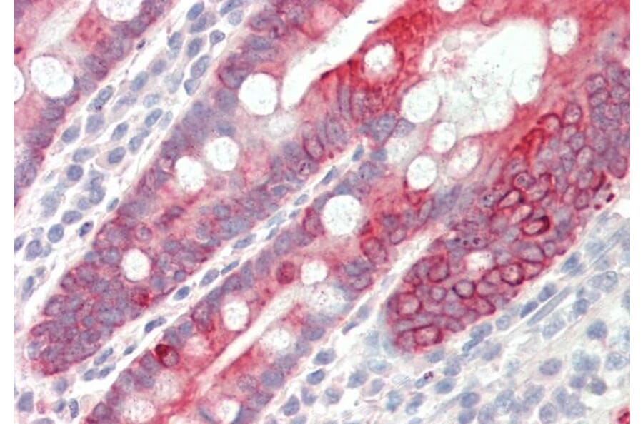 Immunohistochemistry - Anti-Cytokeratin 18 Antibody (A83652) - Antibodies.com