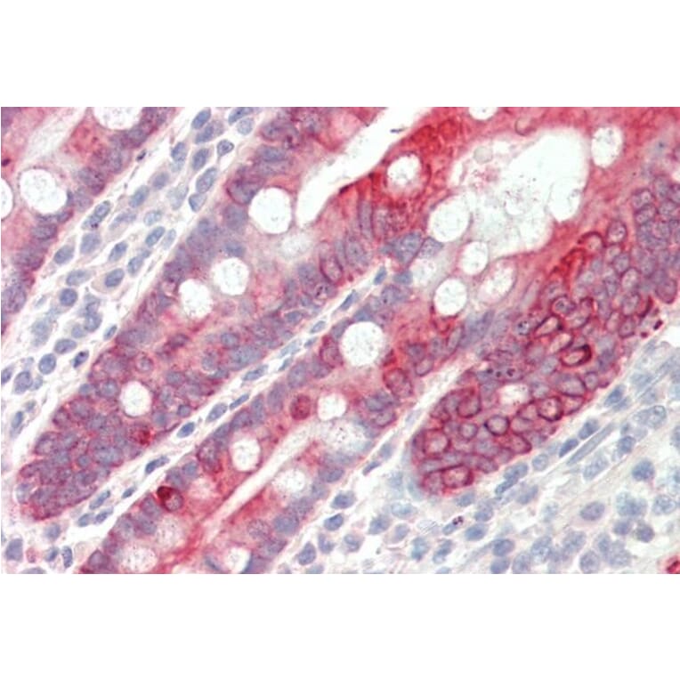 Immunohistochemistry - Anti-Cytokeratin 18 Antibody (A83652) - Antibodies.com