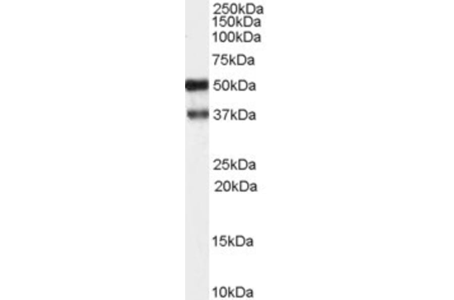 Western Blot - Anti-PACSIN1 Antibody (A83653) - Antibodies.com