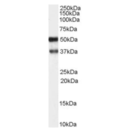 Western Blot - Anti-PACSIN1 Antibody (A83653) - Antibodies.com