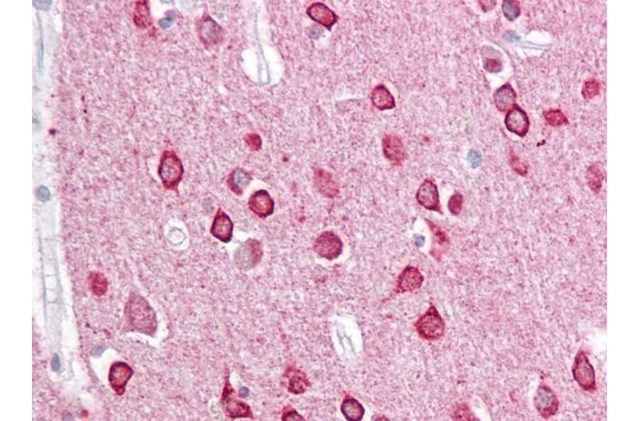 Immunohistochemistry - Anti-PACSIN1 Antibody (A83653) - Antibodies.com
