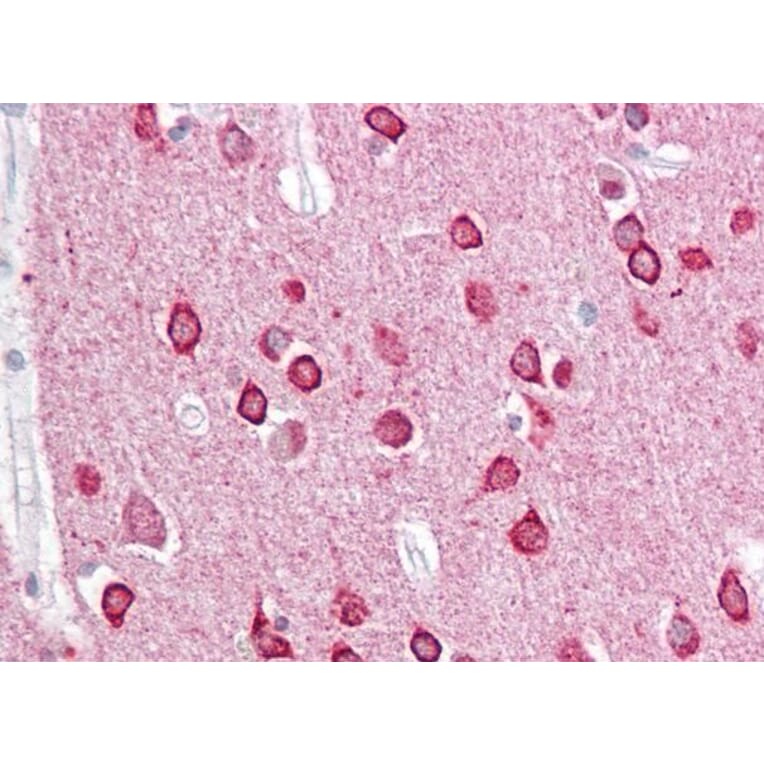 Immunohistochemistry - Anti-PACSIN1 Antibody (A83653) - Antibodies.com
