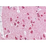 Immunohistochemistry - Anti-PACSIN1 Antibody (A83653) - Antibodies.com