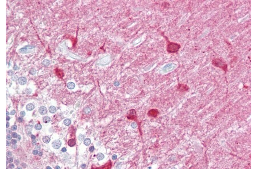 Immunohistochemistry - Anti-PACSIN1 Antibody (A83653) - Antibodies.com