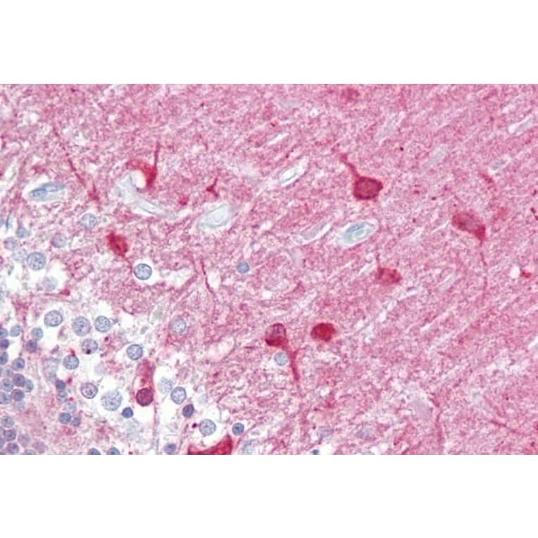 Immunohistochemistry - Anti-PACSIN1 Antibody (A83653) - Antibodies.com