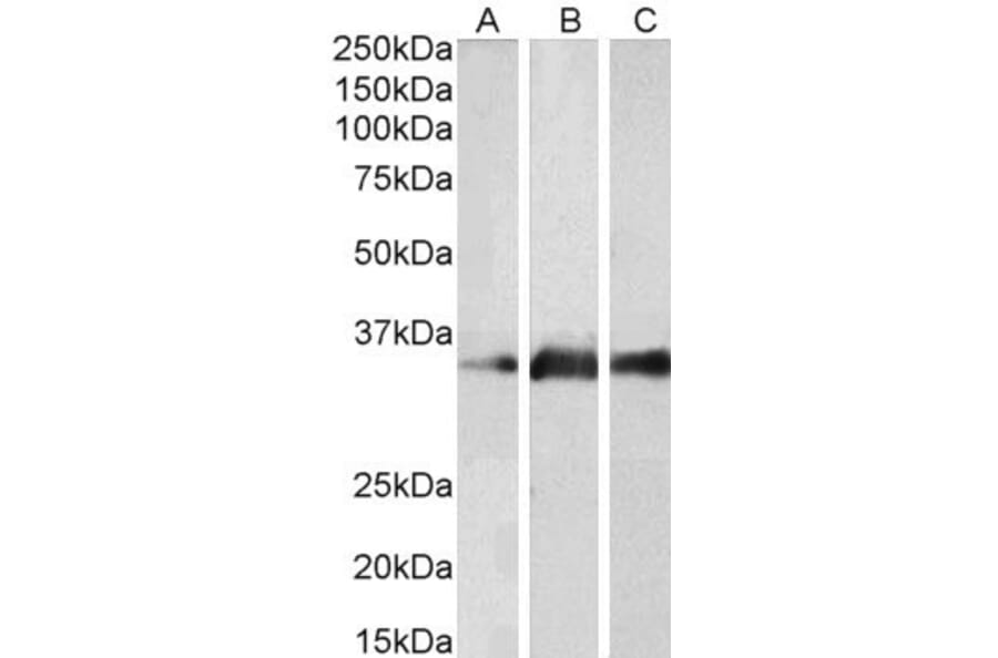 Western Blot - Anti-Kallikrein 5 Antibody (A83655) - Antibodies.com