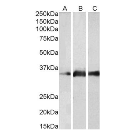 Western Blot - Anti-Kallikrein 5 Antibody (A83655) - Antibodies.com