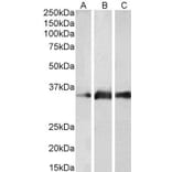 Western Blot - Anti-Kallikrein 5 Antibody (A83655) - Antibodies.com