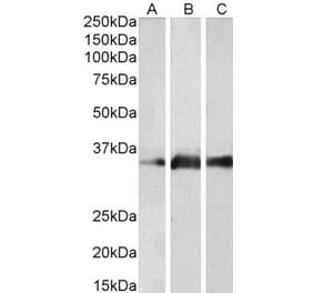 Western Blot - Anti-KLK5 Antibody (A83655) - Antibodies.com