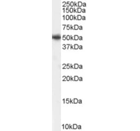 Western Blot - Anti-PICK1 Antibody (A83656) - Antibodies.com