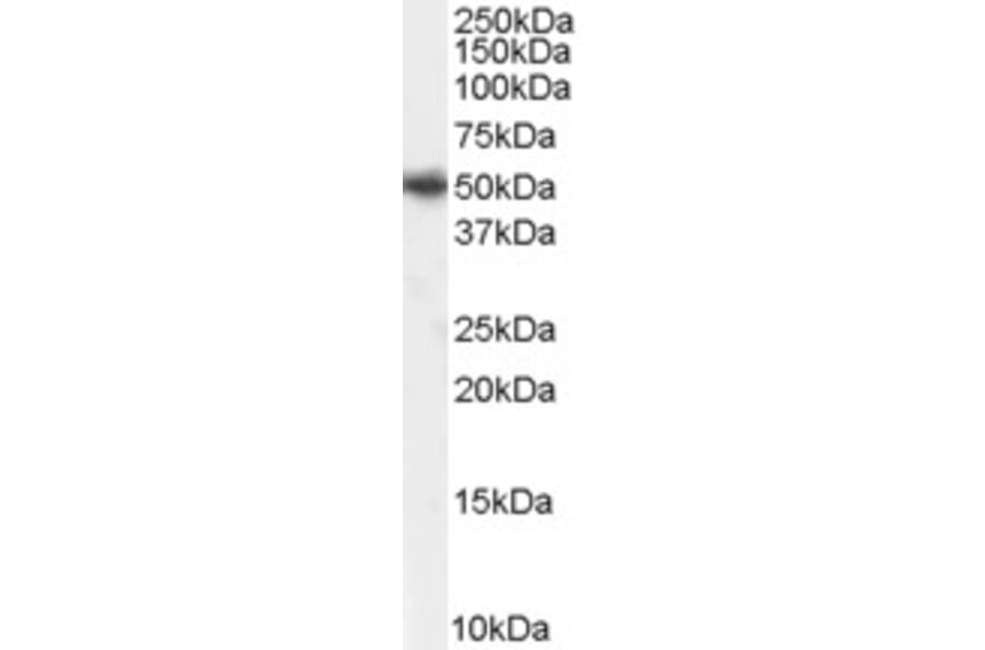 Western Blot - Anti-PICK1 Antibody (A83656) - Antibodies.com