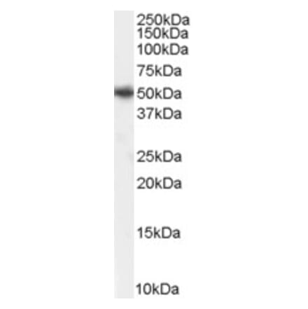 Western Blot - Anti-PICK1 Antibody (A83656) - Antibodies.com