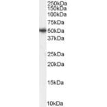 Western Blot - Anti-PICK1 Antibody (A83656) - Antibodies.com