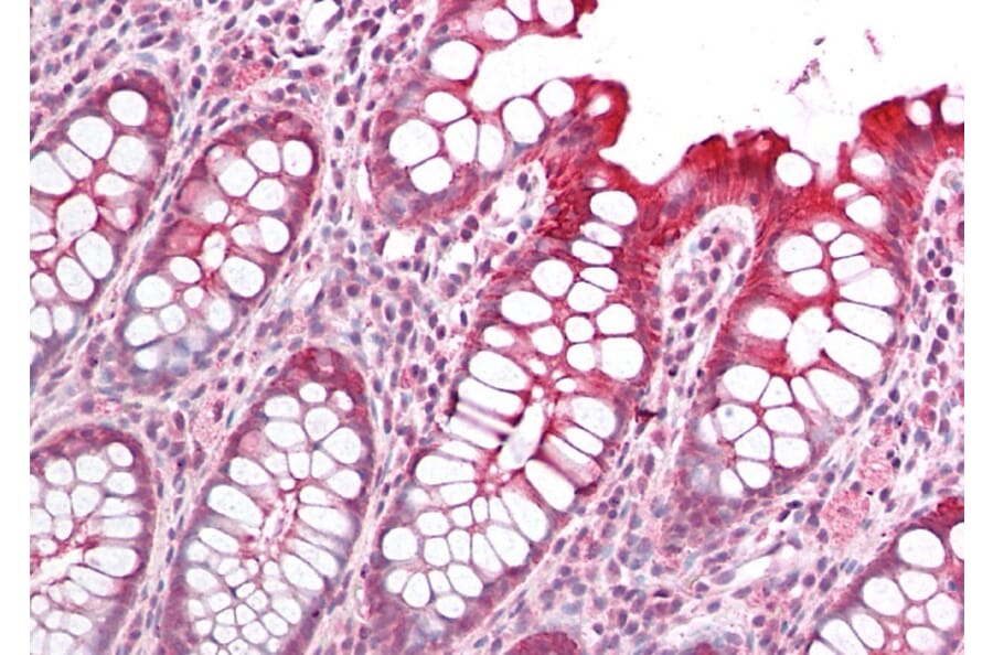 Immunohistochemistry - Anti-PICK1 Antibody (A83656) - Antibodies.com