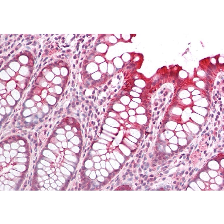 Immunohistochemistry - Anti-PICK1 Antibody (A83656) - Antibodies.com