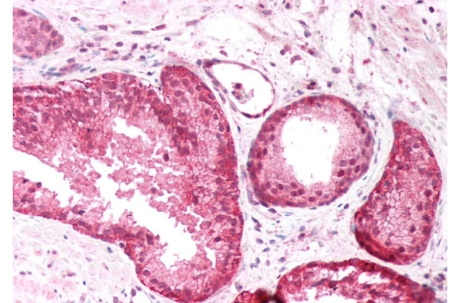 Immunohistochemistry - Anti-PICK1 Antibody (A83656) - Antibodies.com
