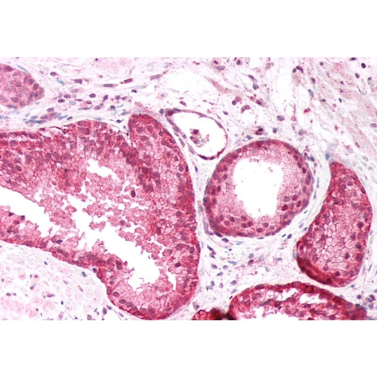 Immunohistochemistry - Anti-PICK1 Antibody (A83656) - Antibodies.com