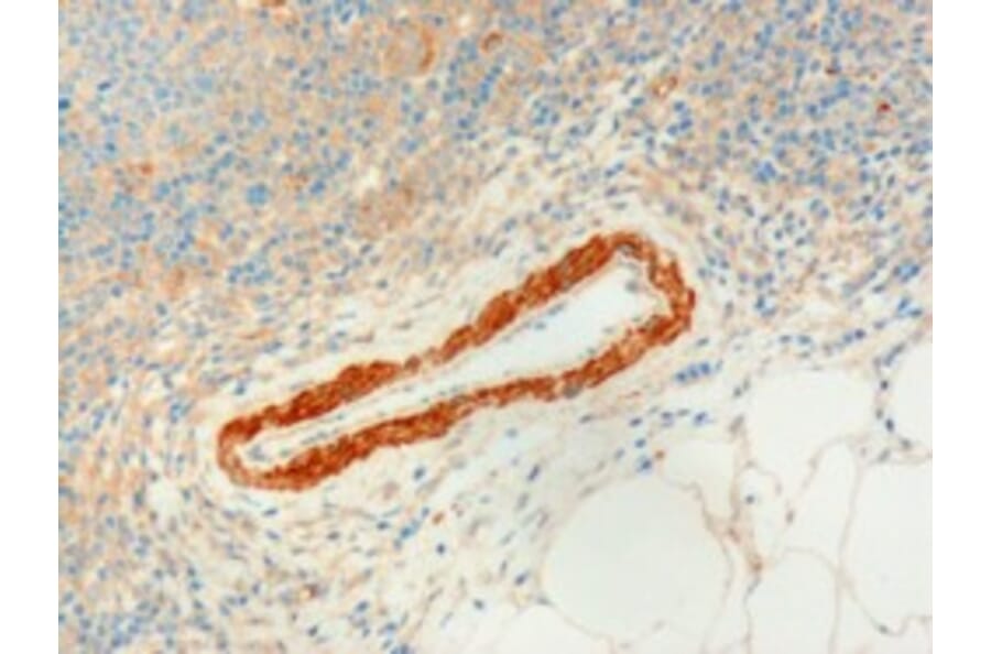 Immunohistochemistry - Anti-USP20 Antibody (A83658) - Antibodies.com