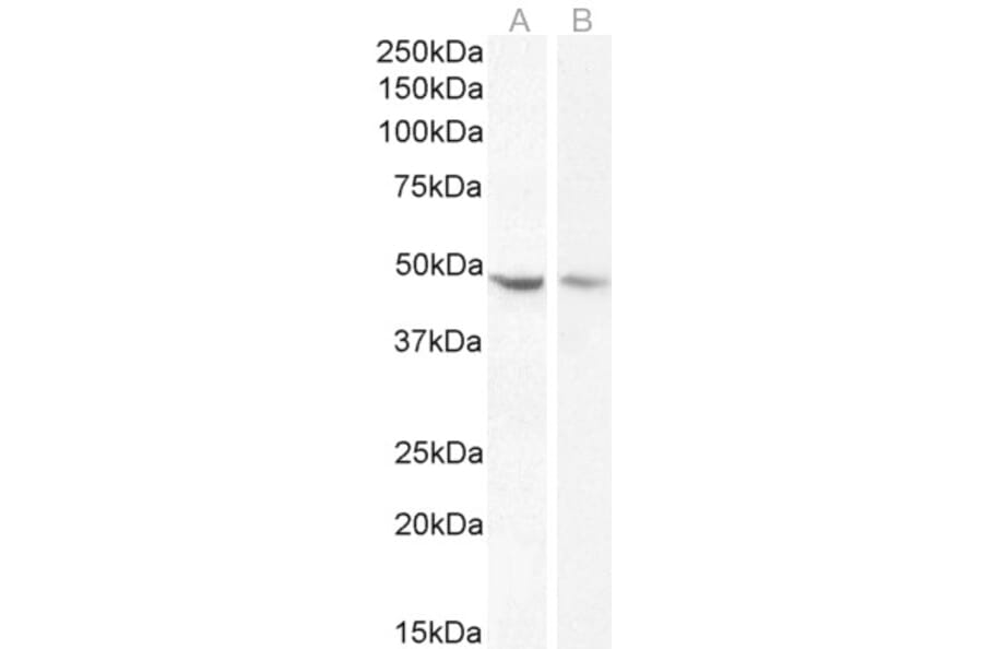 Western Blot - Anti-Neuroserpin Antibody (A83659) - Antibodies.com