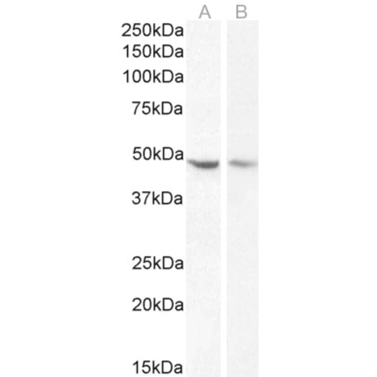 Western Blot - Anti-Neuroserpin Antibody (A83659) - Antibodies.com