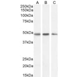 Western Blot - Anti-Neuroserpin Antibody (A83659) - Antibodies.com