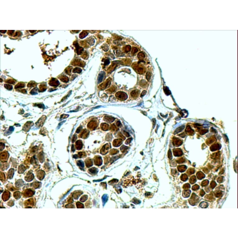 Immunohistochemistry - Anti-APE1 Antibody (A83661) - Antibodies.com